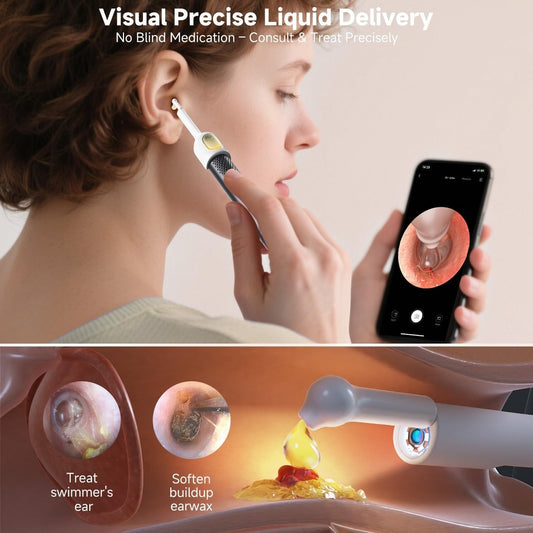 Ear Wax Removal Kit With HD Camera